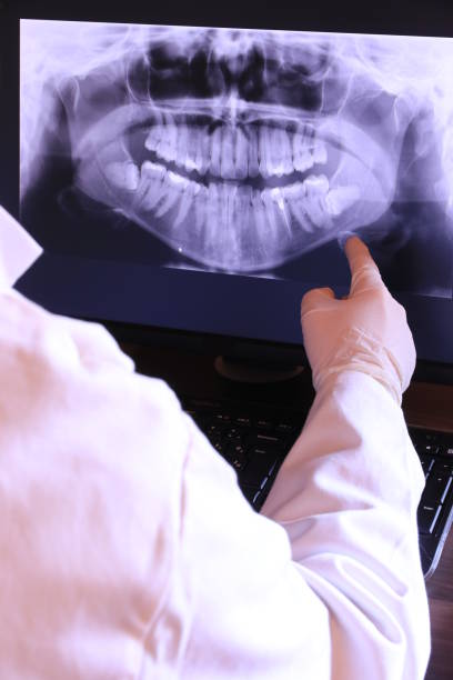 Best Emergency Dental Extractions in Purdy, WA
